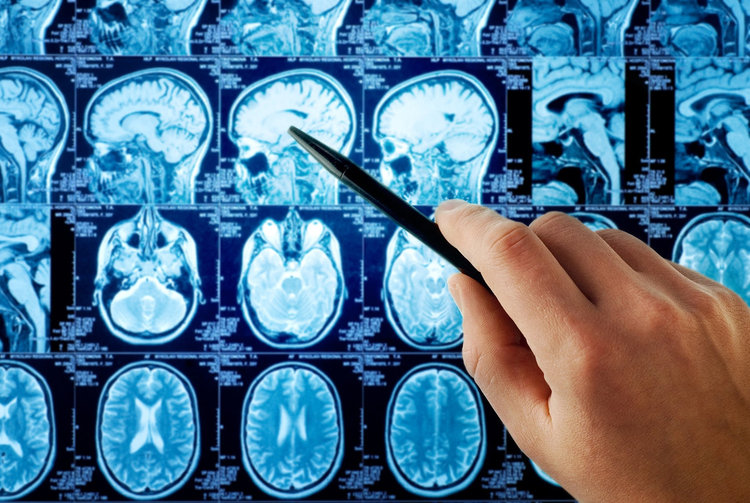 Изкуствен интелект определя IQ без тестове, по активността на мозъка
