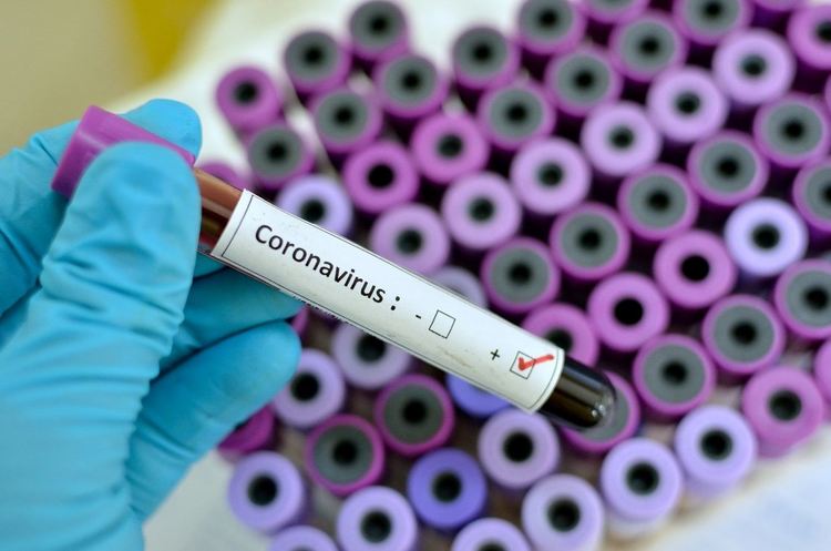 Недостиг на направления за тестване за коронавирус в Благоевград