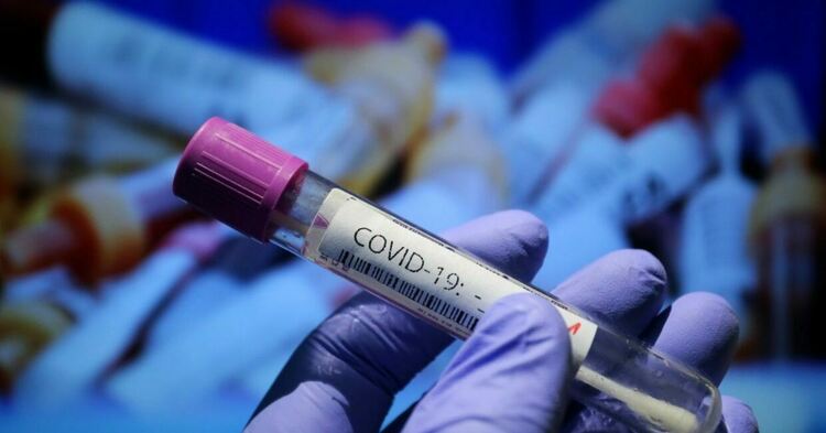 22-ма са починалите с COVID-19 в област Пловдив за последното денонощие 