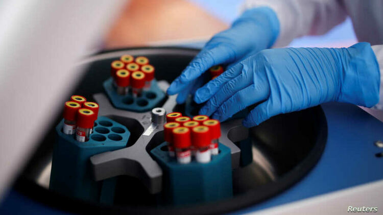 113 нови случая на COVID-19 за денонощие